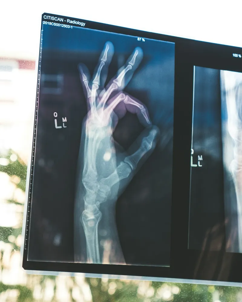 Imaging & Analysis